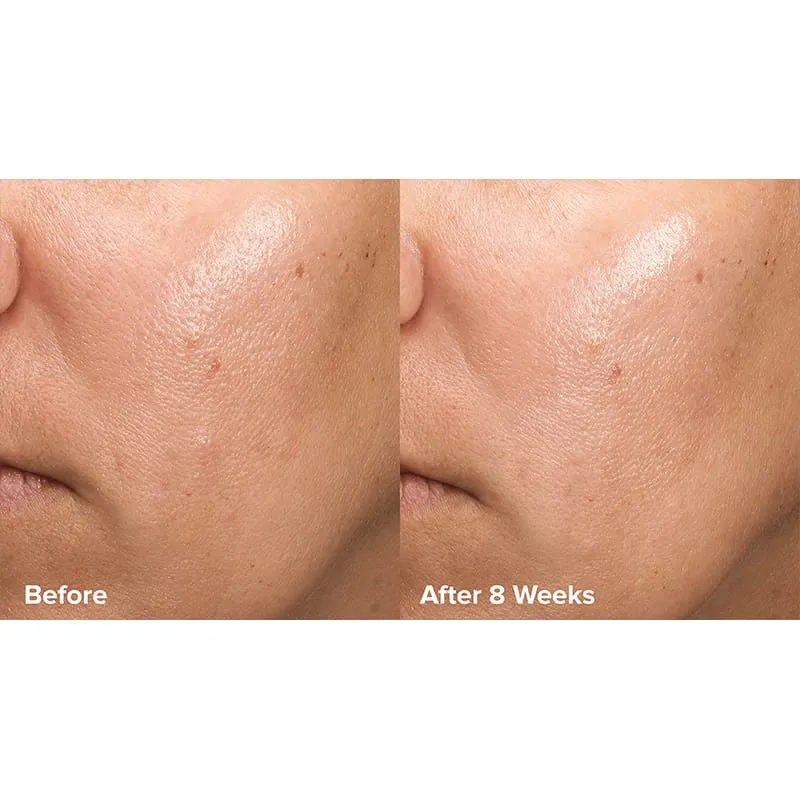 Paula's choice Skin Perfecting 6% Mandelic Acid   2% Lactic Acid Liquid Exfoliant Travel Size