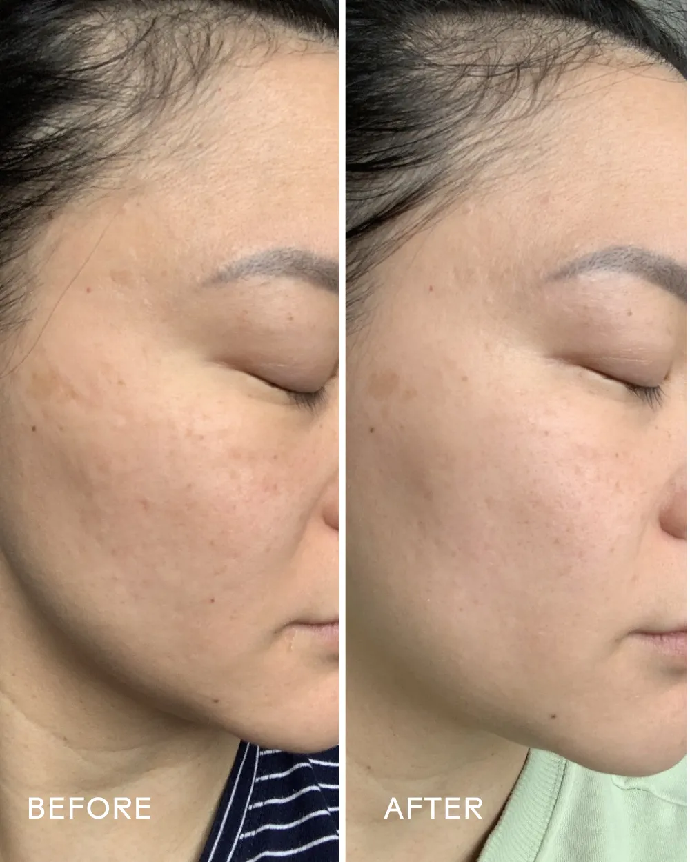 Radiance Grape Stem Cell   Squalane Ultra-Hydrating Cream